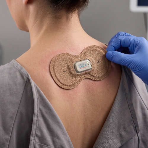 Iontophoresis-choice-physical-therapy-corning-ny