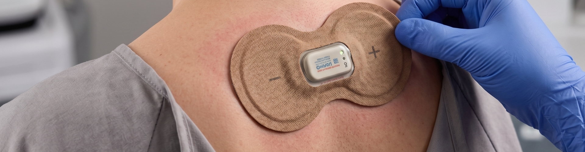 Iontophoresis